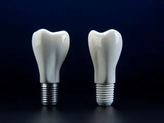 Záruky na zubní implantáty a nejen na ně